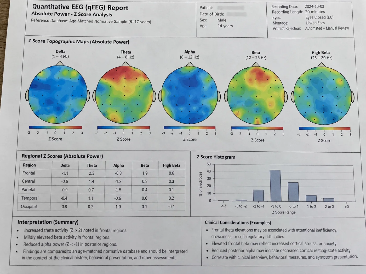 A sample qEEG brain map report showing topographic Z-score maps